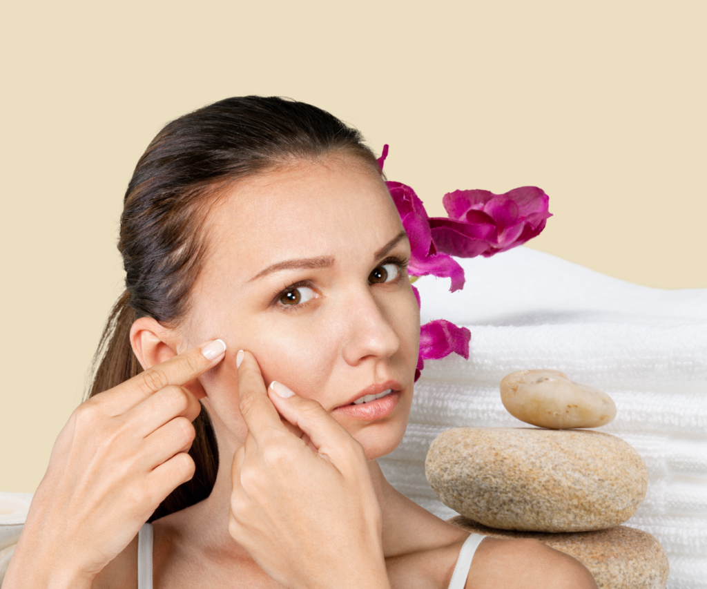 Blog Anti Acne Skincare Range WillaKrause | Skin Care