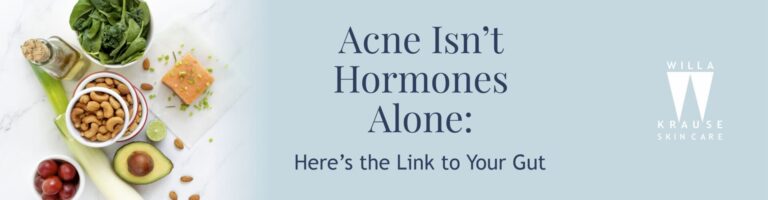 Acne Isn’t Hormones Alone: Here’s the Link to Your Gut | Skin Care | 1 14 7 2025 Blogs Ance isnt Hormones alone Banner | Skin Care