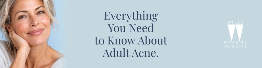 2026 09 Adult Acne banner | Skin Care